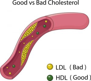 Colesterol bueno y malo