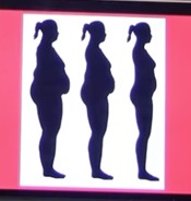 obesidad en la mujer