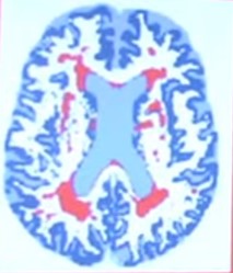Cerebro